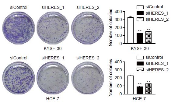 KYSE-30, HCE-7 두 암세포 군락에 HERES를 억제한 결과 암세포 군락이 현저히 줄어 HERES가 암세포 증식에 관여한다는 사실을 확인했다. (그림=세브란스)