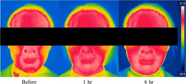 아모레퍼시픽, 마스크 착용 피부 변화에 미치는 연구 결과 발표