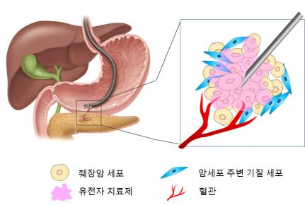 분당서울대병원 소화기내과 황진혁, 이종찬 교수 연구팀 