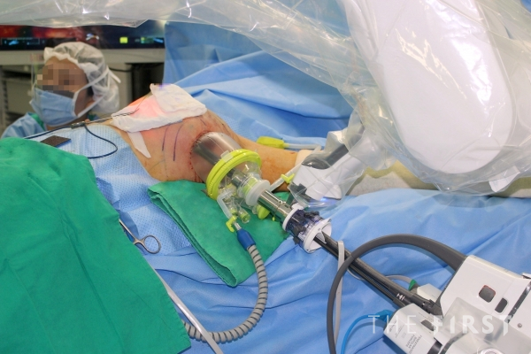 연세암병원, 국내 첫 유방암 로봇수술 200례 달성